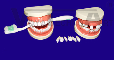 Dental care model with 6 removable tooth